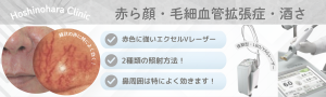 福岡・毛細血管拡張症・赤ら顔・酒さのレーザー治療が得意