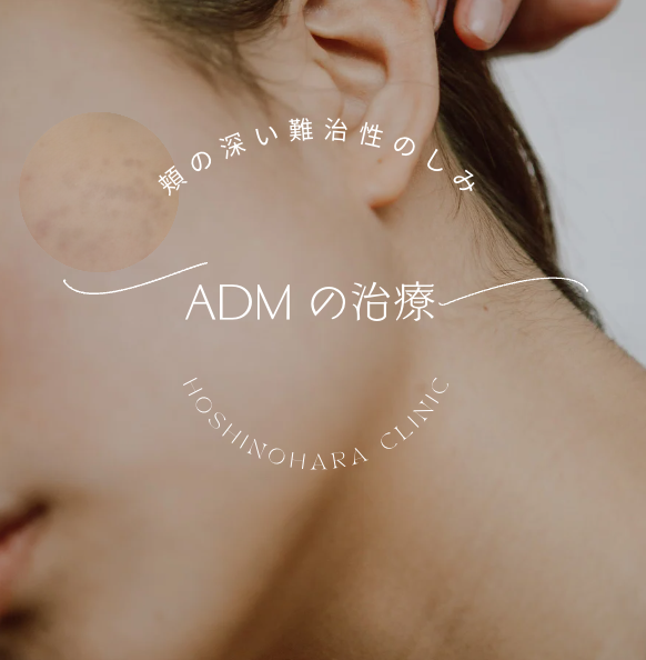 ADMの治療